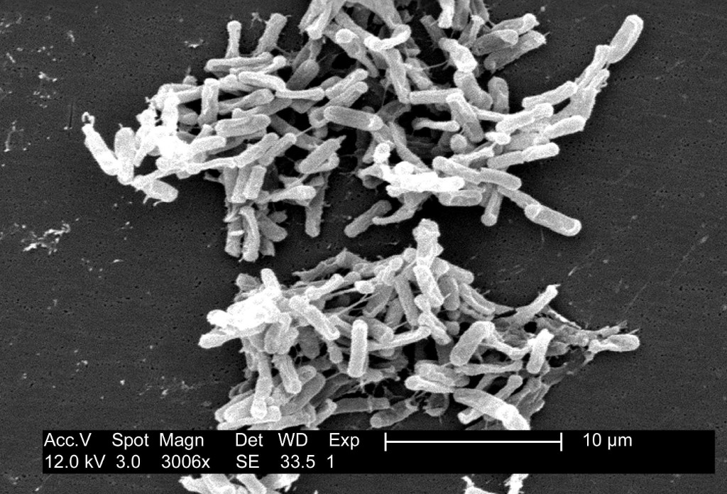 Vô hiệu hoá Clostridium difficile